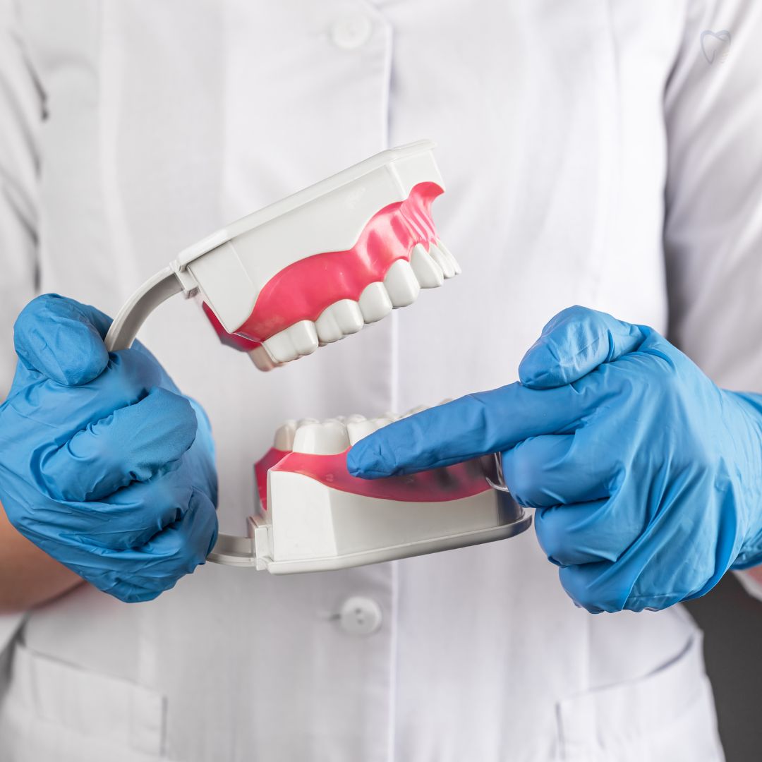 A exodontia de terceiros molares, também conhecida como extração de sisos, é um procedimento cirúrgico frequentemente realizado para remover os últimos dentes a nascer na boca.