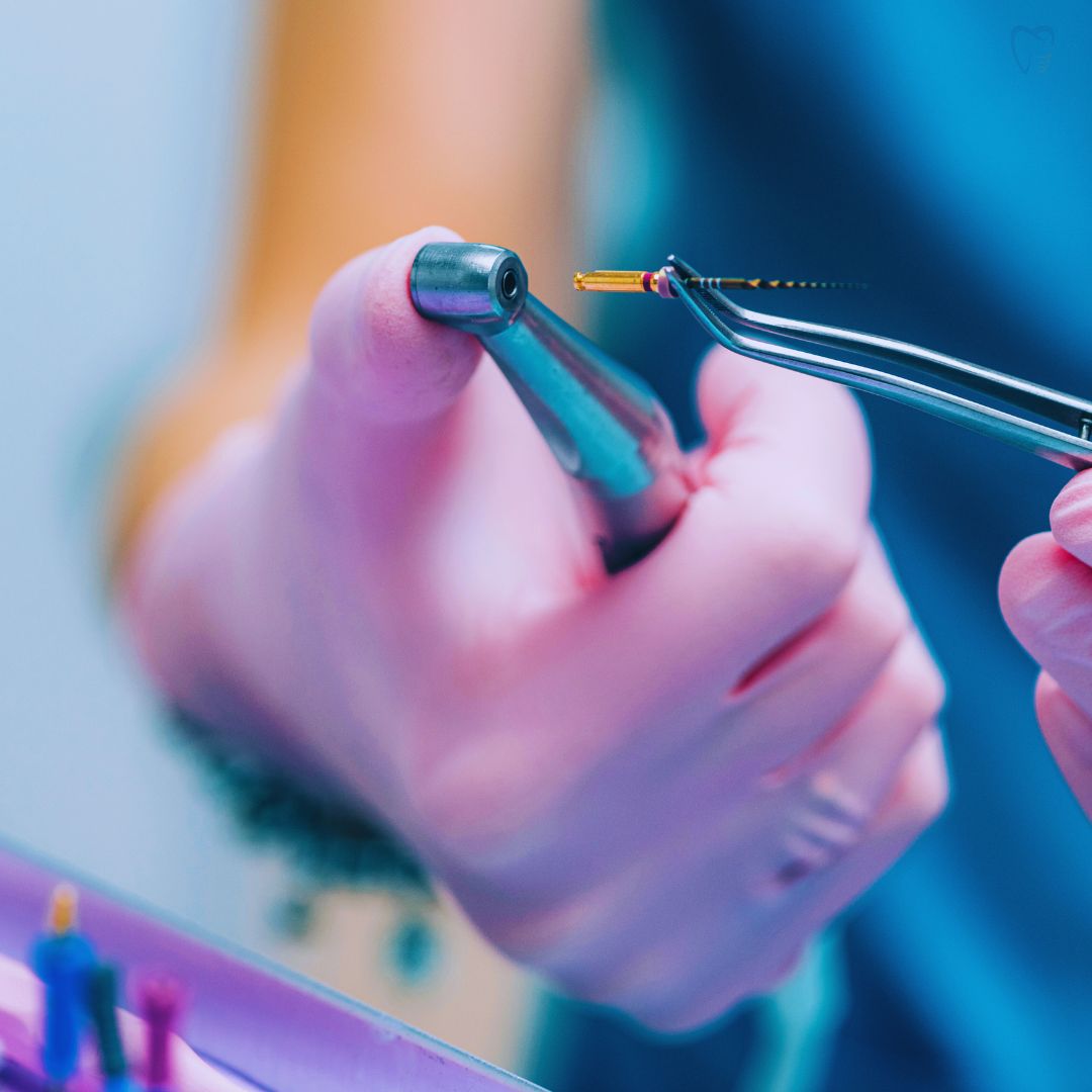 O tratamento de canal é um procedimento odontológico vital que é realizado quando a polpa do dente - o tecido mole dentro do dente que contém nervos e vasos sanguíneos - fica inflamada ou infectada.