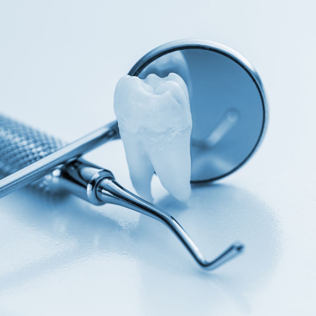 Embora a escovação diária e o uso do fio dental sejam práticas fundamentais, a profilaxia realizada por um profissional qualificado garante a remoção completa de placa bacteriana e tártaro que, frequentemente, não são eliminados apenas com os métodos caseiros.