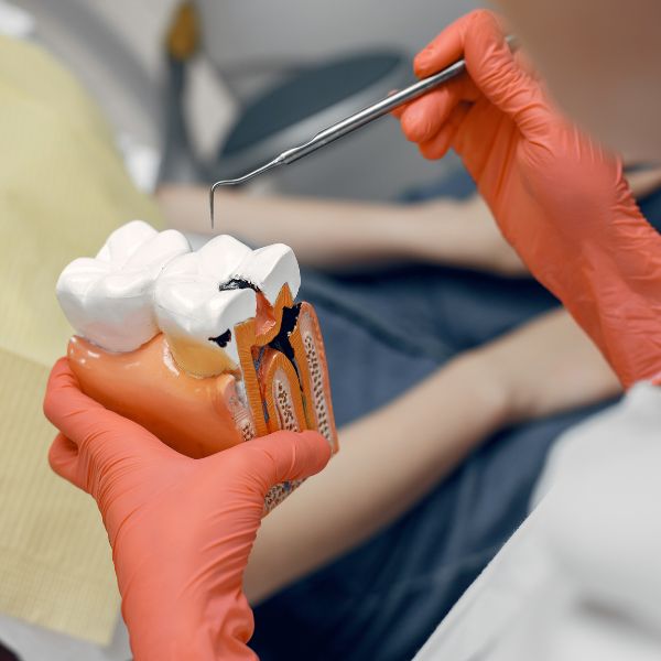 Endodontia: O Tratamento que Salva seu Sorriso.