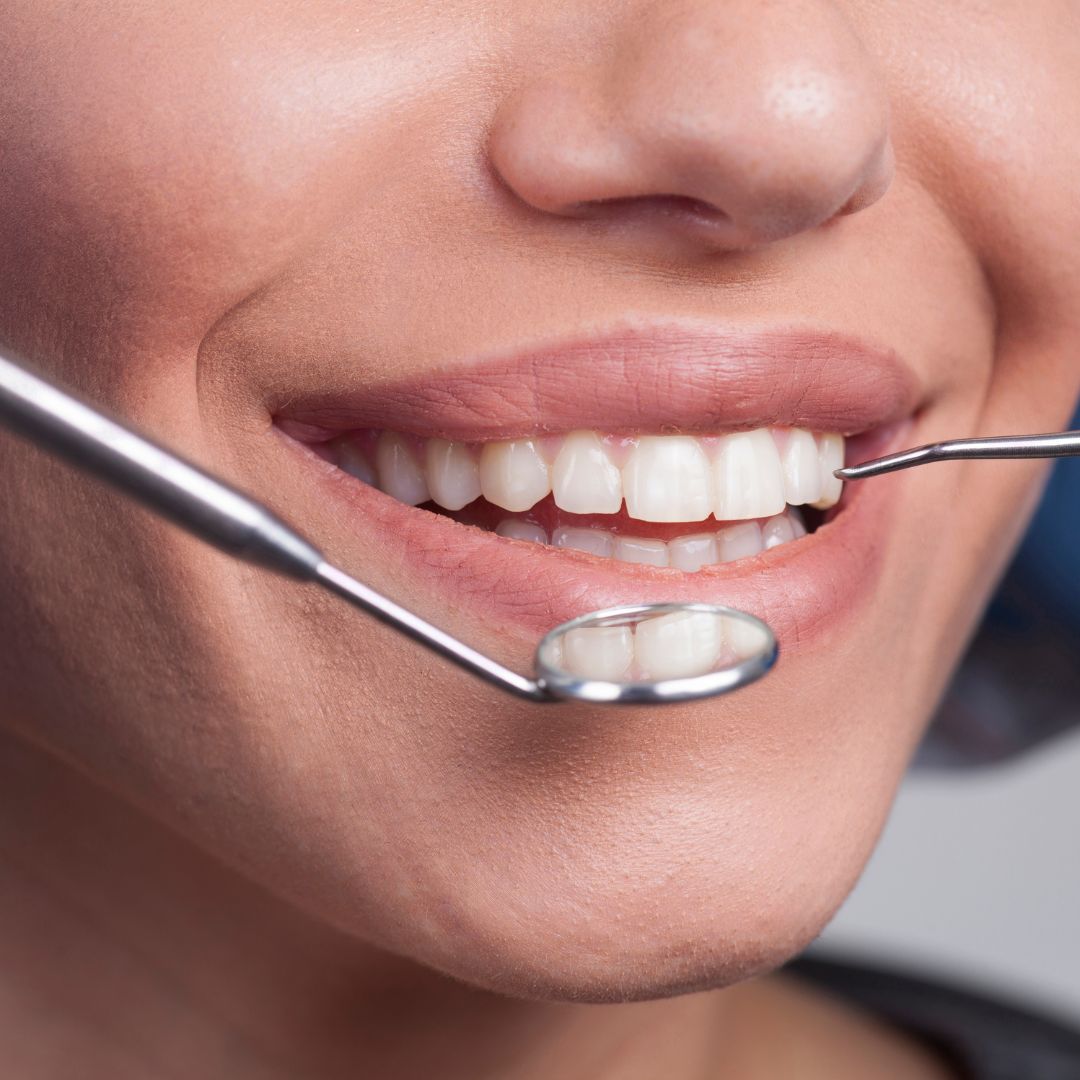 O tratamento periodontal é um conjunto de procedimentos destinados a prevenir e tratar infecções que afetam as gengivas e os tecidos que sustentam os dentes.